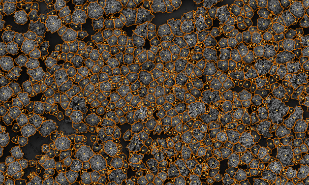 La forêt sous IA La forêt sous IA